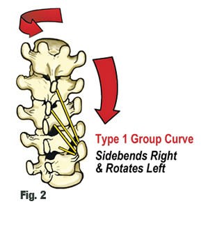 skolioza - rotacija prsljenova
